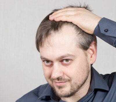 3 haircuts for guys with big foreheads 💪🏼 #barber #barbertiktok #dan... |  TikTok