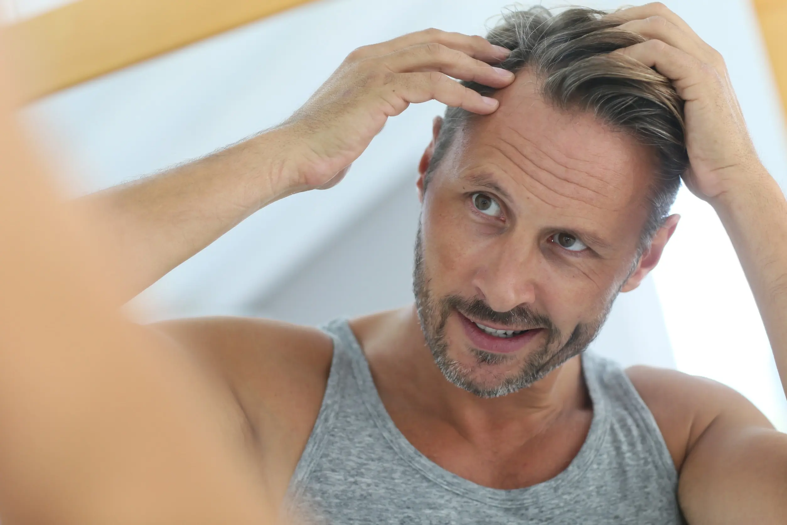 dry scalp winter